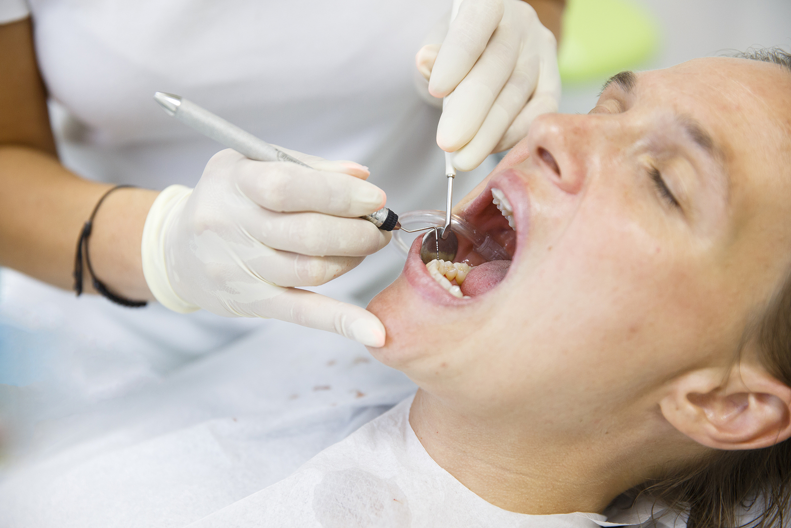 Common Dental Problems You Can Avoid with Preventive Care